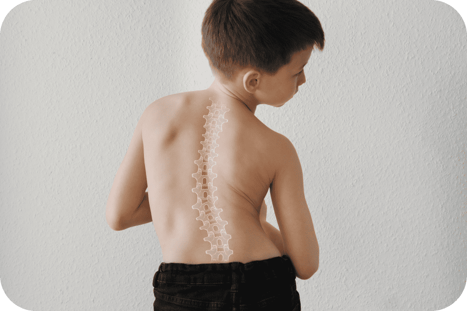 Boy with scoliosis