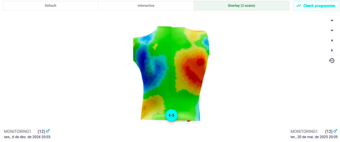Compare Scans Overlay