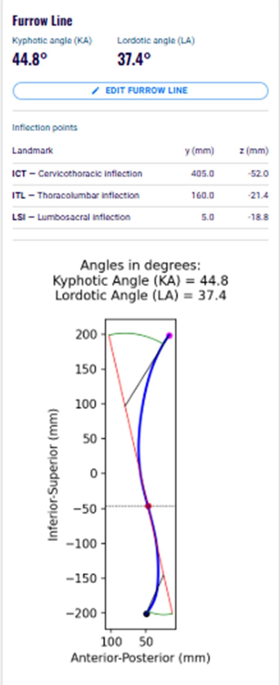 Sagittal plane panel
