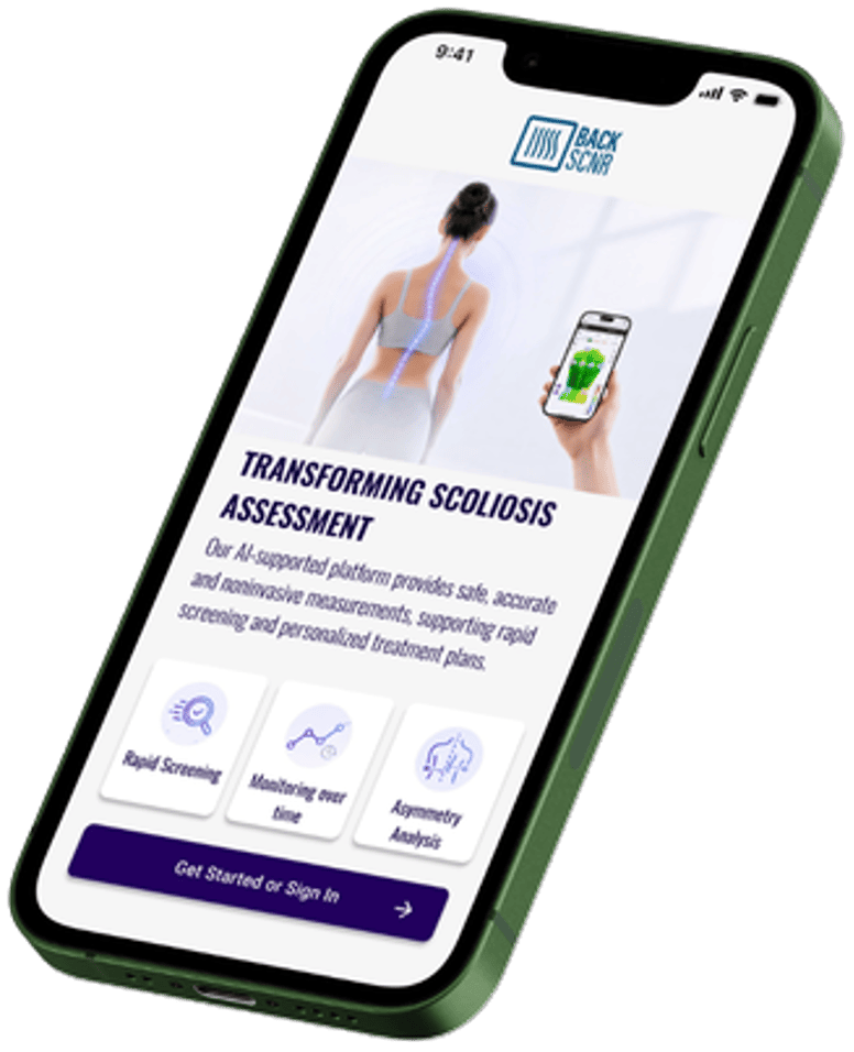 iPhone for scoliosis assessment
